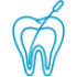 root-canal